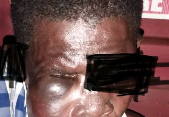 A Teacher Brutally Beaten by a Parent